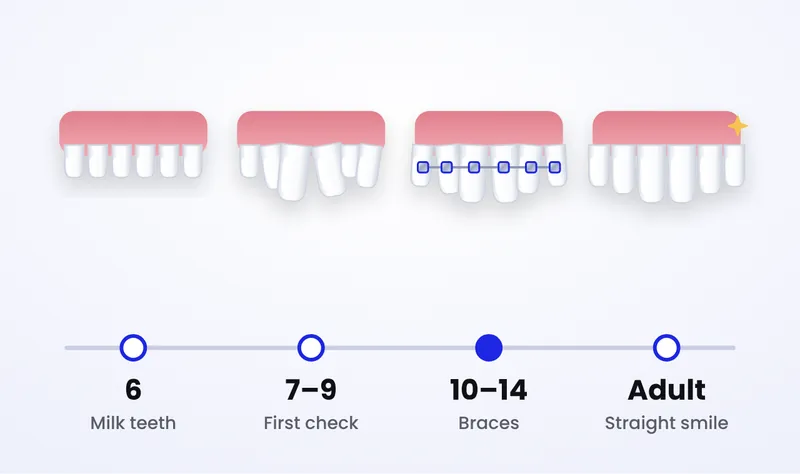 Illustration of a timeline showing milk teeth at age 6, mixed teeth at age 7 to 9, braces at age 10 to 14 and a straight adult smile