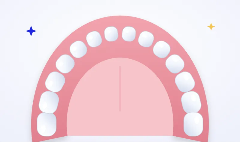 Illustration of a complete upper denture with a full arch of teeth on a gum-coloured base