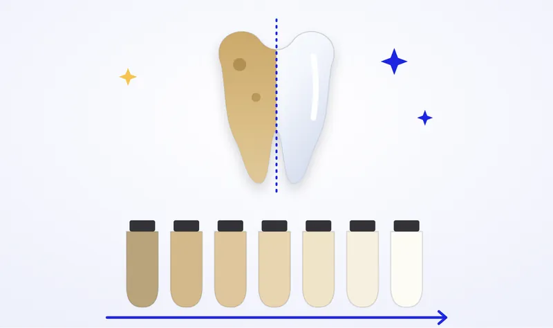 Illustration of teeth whitening: a stained tooth surface beside a whitened one, above a dental shade guide
